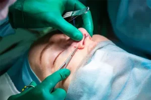 درصد و ریسک مرگ در جراحی بینی