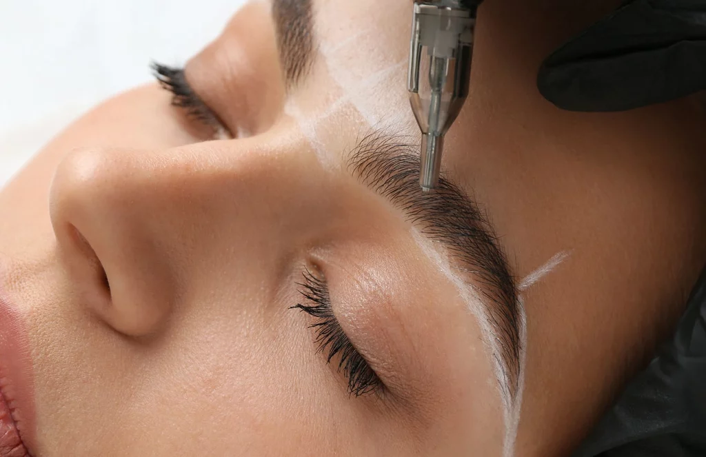 آنالیز تخصصی کاشت ابرو با روش‌های FUE و Micrograft