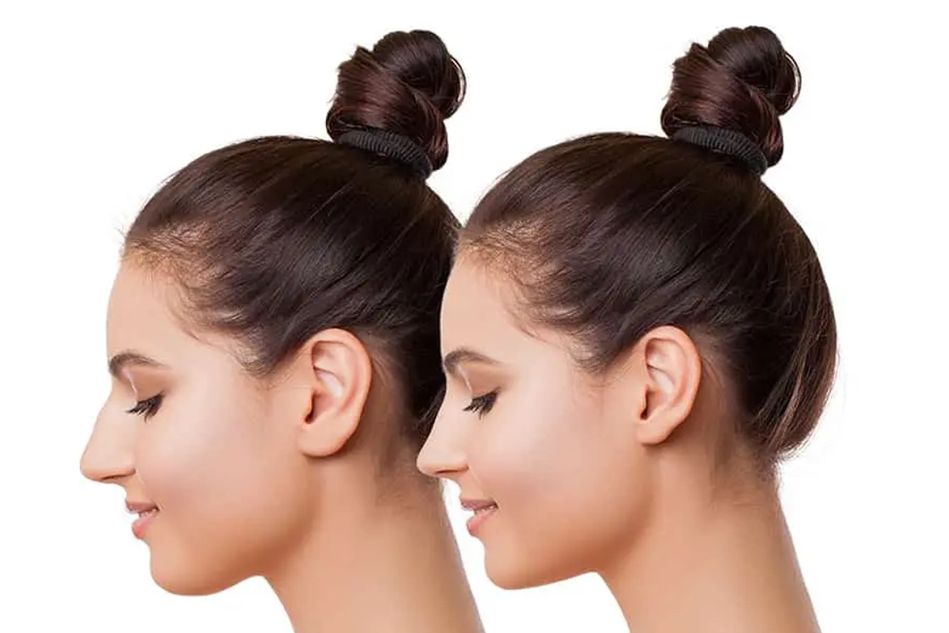 بهترین جراحی بینی در ایلام